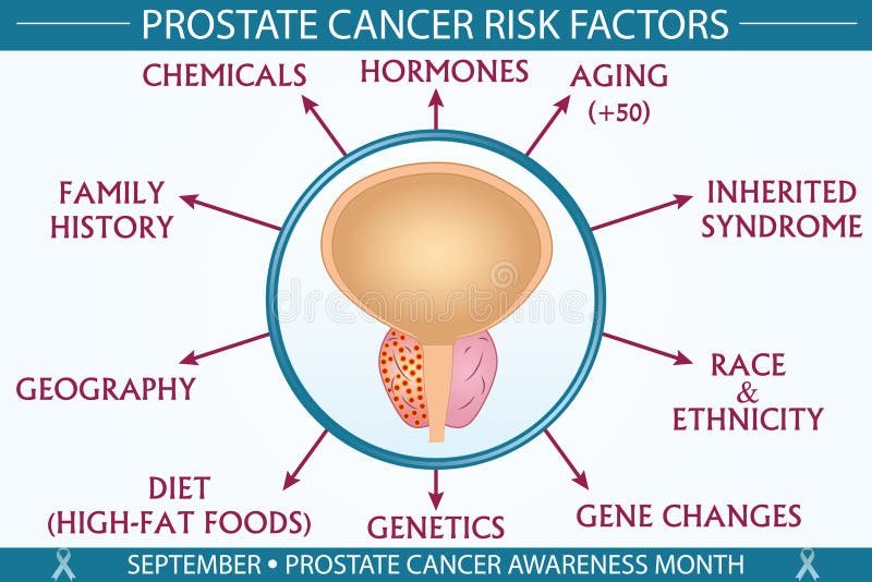 Prostate Cancer Infographic Stock Illustrations – 698 Prostate ...
