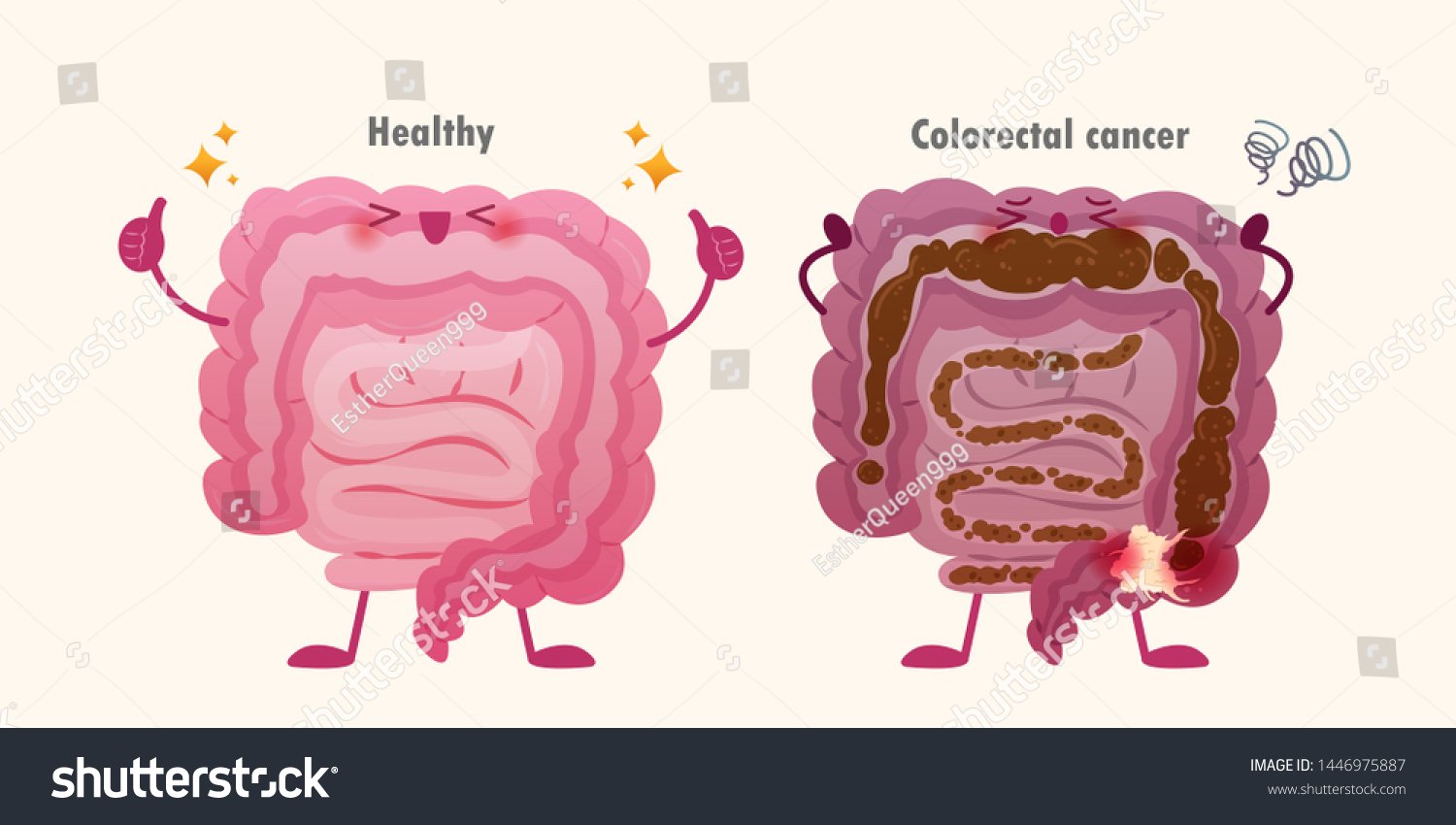 Healthy Unhealthy Intestine Colorectal Cancer Issue Stock ...